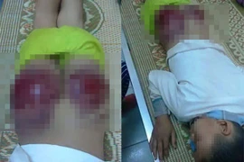 Cháu bé bị bố đánh nát mông vì bỏ học chơi game