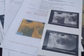 Góc khuất nghề đẻ thuê (5): Người thuê "phủi tay" vì thai nhi là con gái