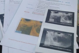 Góc khuất nghề đẻ thuê (5): Người thuê "phủi tay" vì thai nhi là con gái