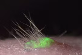 Nhật Bản nghiên cứu thành công da nhân tạo