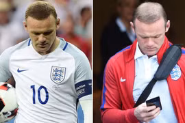 Sốc: Tóc Rooney rụng tả tơi sau thất bại trước Iceland