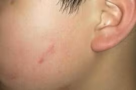 Đề nghị đình chỉ, cảnh cáo cô giáo cho 43 học sinh tát bạn