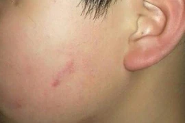 Đề nghị đình chỉ, cảnh cáo cô giáo cho 43 học sinh tát bạn