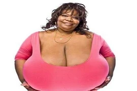 Choáng với người phụ nữ có bộ ngực “khủng” nhất thế giới