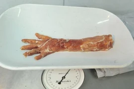 Chết ngất với cửa hàng thịt bán “bộ phận cơ thể người”