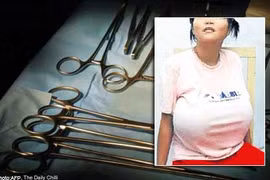 Phát khổ vì ngực khủng