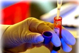 Xét nghiệm máu mới có thể loại trừ đau tim nhanh hơn