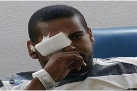 "Dê xồm" bị bắn thủng mắt khi giở trò