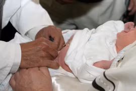 Giảm tỉ lệ cắt bao quy đầu làm tăng tỉ lệ bệnh tình dục