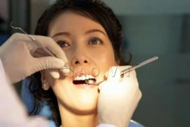 Vệ sinh răng miệng tốt, phòng bệnh viêm tim