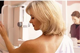 Sàng lọc giúp giảm 1/2 nguy cơ tử vong do ung thư vú