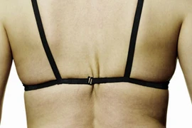 Tác hại khi chị em mặc áo ngực chặt