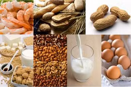 Béo phì do dị ứng thực phẩm