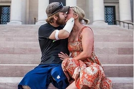 Chuyện tình cảm động của chàng thương binh Mỹ mất cả tứ chi