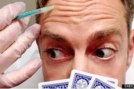 Quảng cáo tiêm Botox để giữ mặt lạnh khi đánh bạc