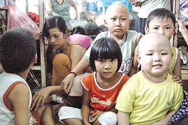 Dị tật bẩm sinh liên quan tới ung thư ở trẻ em