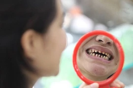 Mẹ thẩm mỹ răng hỏng, con khóc thét 