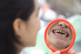 Mẹ thẩm mỹ răng hỏng, con khóc thét 