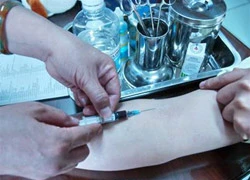 Phát hiện các bệnh chỉ báo mới về nhiễm HIV