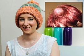 Đáng thương cô gái trẻ phải đội “quả bóng golf” trên đầu