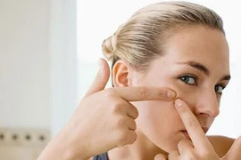 Virus vô hại giúp tiêu diệt mụn trứng cá hiệu quả