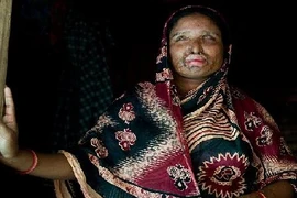 Bị buộc tái hôn với người chồng đã tạt a-xít vào mình