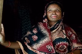 Bị buộc tái hôn với người chồng đã tạt a-xít vào mình