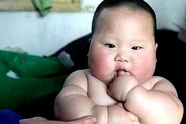 Phát hiện gen gây béo phì hay gặp ở trẻ em