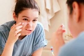 Giúp teen “đánh bay” mụn trứng cá
