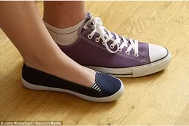 Cô gái có bàn chân “cỡ khủng”