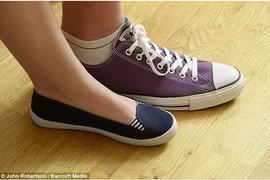 Cô gái có bàn chân “cỡ khủng”