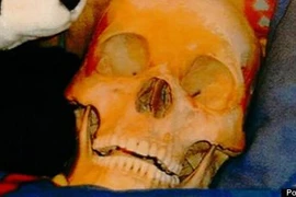 Bị bắt vì dám “mây mưa” với cả… bộ xương người chết