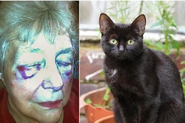 Cụ bà 80 tuổi suýt mù mắt vì...mèo cào