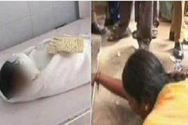 Kinh hoàng chuột gặm thi thể… bé sơ sinh