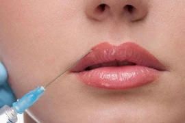 Đi thẩm mỹ tại cơ sở hành nghề "chui", thiếu nữ bị hoại tử toàn bộ môi dưới