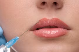 Đi thẩm mỹ tại cơ sở hành nghề "chui", thiếu nữ bị hoại tử toàn bộ môi dưới