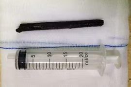 Hải Dương: Uống rượu say đi xe đạp, bị cành cây đâm xuyên hộp sọ