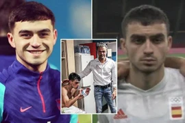 'Sao mai' bóng đá Tây Ban Nha phờ phạc khi dự Olympic 
