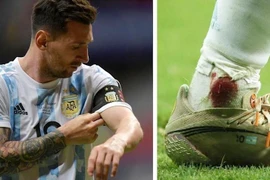 Sốc với hình ảnh cổ chân chảy máu của Messi ở bán kết Copa America