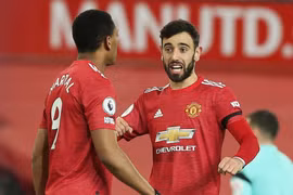 M.U nhận tin cực vui trước đại chiến với Liverpool