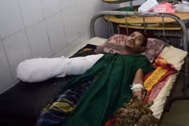 "Người cây" phẫu thuật loại bỏ 5kg "vỏ"