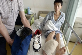 Chàng thanh niên Trung Quốc khốn khổ vì “bàn chân khổng lồ” 