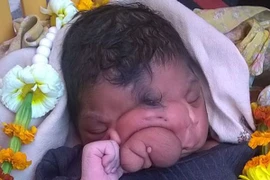 Bé gái được thờ phụng như thần thánh với khuôn mặt giống chiếc vòi voi