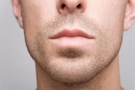 Nhiễm HPV miệng làm tăng nguy cơ ung thư đầu và cổ