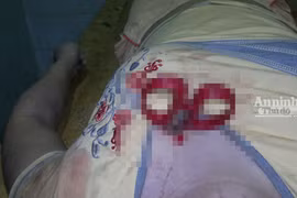 Đã bắt được kẻ đâm ngập chiếc kéo vào ngực cô gái trẻ