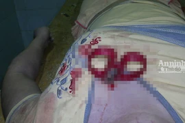 Đã bắt được kẻ đâm ngập chiếc kéo vào ngực cô gái trẻ