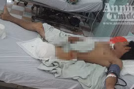 Kinh hoàng: Một người bị máy xay đá lạnh nghiến nát chân