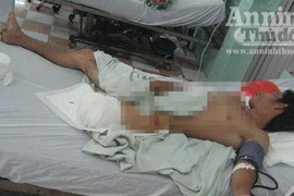 Kinh hoàng: Một người bị máy xay đá lạnh nghiến nát chân