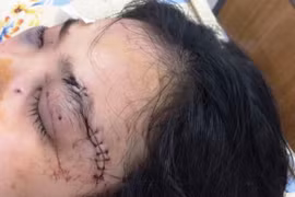 Điều tra vụ cô gái dẫn 20 giang hồ truy sát kinh hoàng 1 thiếu nữ 16 tuổi