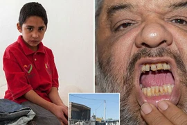 Durango (Mexico): 7 tuổi đã nghiện "đập đá"